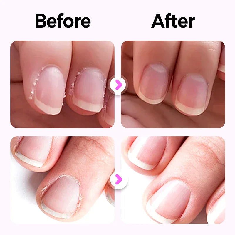 VivoNail™ Precision Pen — Transform Fragile Nails into Stunning, Confident Beauty Every Day