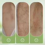 SensaSilk™ — Unlock Pain-Free, Silky Smooth Skin That Turns Heads Instantly