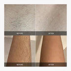 SilkEssence™ — Unlock Irresistibly Smooth Skin That Boosts Your Confidence Every Day
