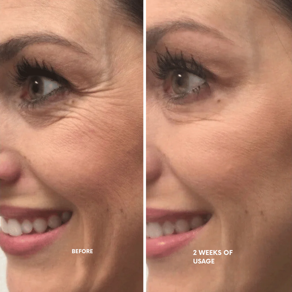 LumaFirme™ — Reveal Firmer, Radiant Skin That Turns Back Time in Just 14 Days