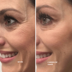 LumaFirme™ — Reveal Firmer, Radiant Skin That Turns Back Time in Just 14 Days