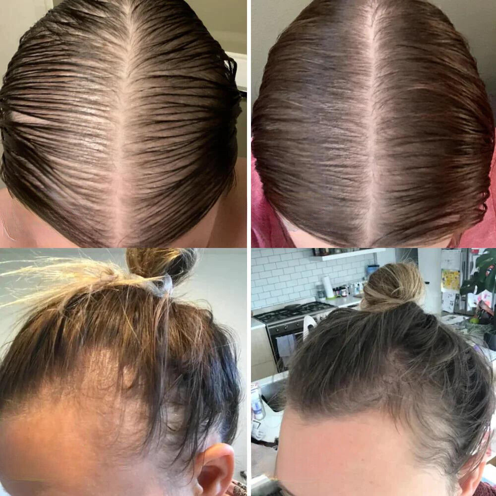 VitaTress™ — Ignite Your Scalp, Unleash Thick, Lush Hair That Commands Attention
