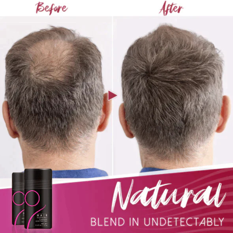 VolumeLuxe™ — Transform Thin, Patchy Hair into a Bold, Youthful Crown Instantly