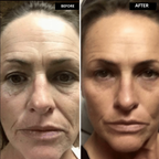 LumaFirme™ — Reveal Firmer, Radiant Skin That Turns Back Time in Just 14 Days