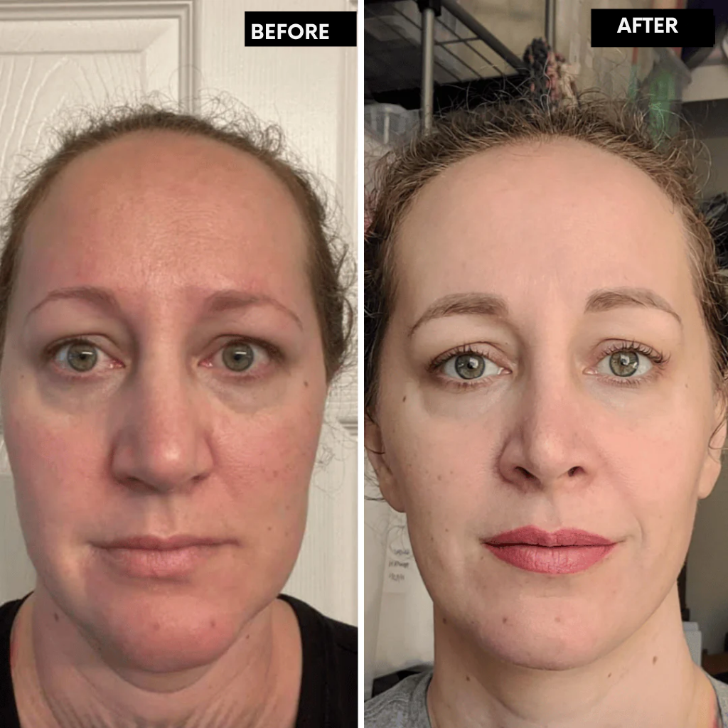 LumaFirme™ — Reveal Firmer, Radiant Skin That Turns Back Time in Just 14 Days