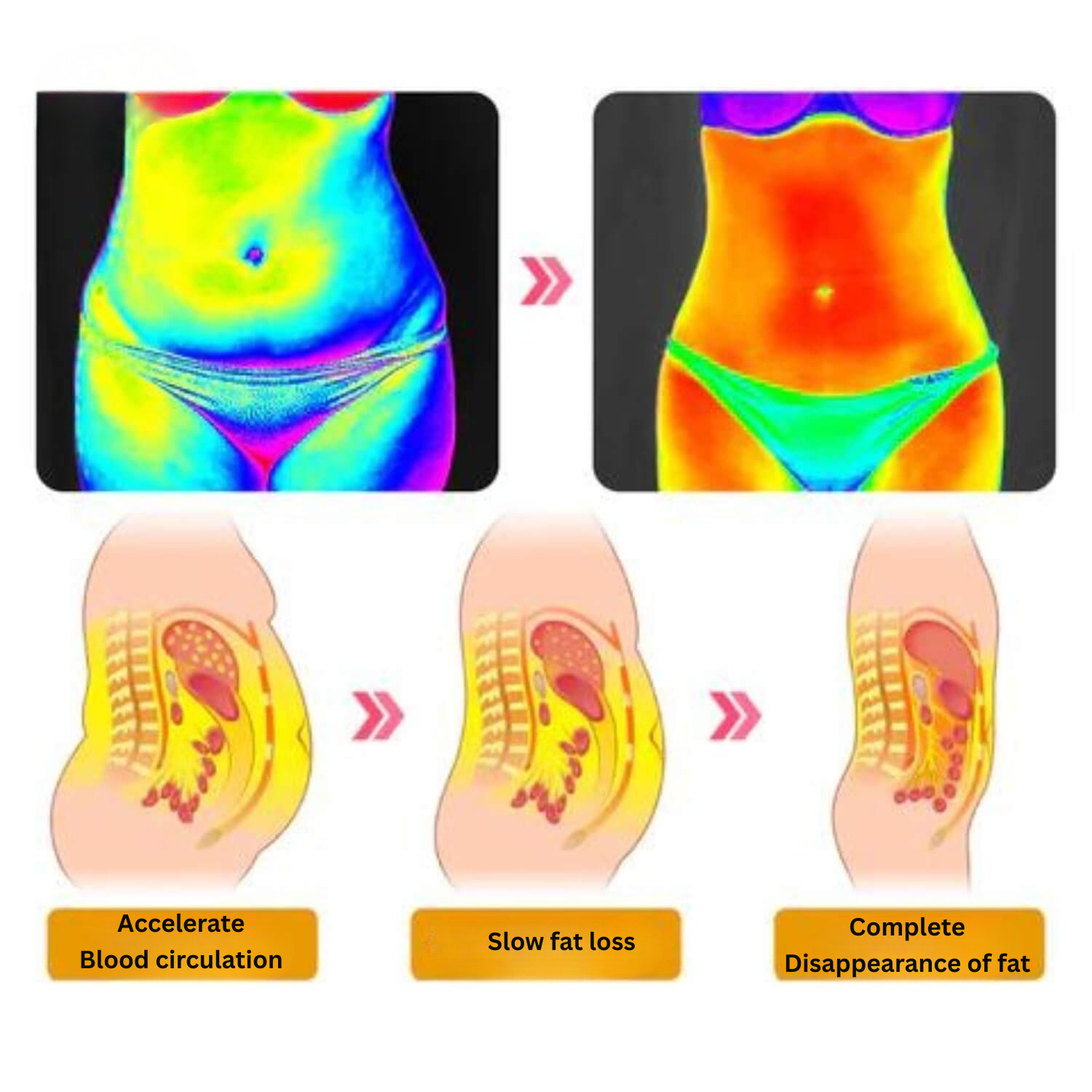 CurveRadiance™ Sculpting Shorts — Ignite Your Curves, Melt Fat, and Radiate Confidence All Day