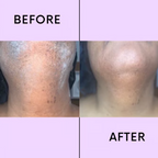 SilkVeil™ — Effortless Hair Removal for Skin That Glows with Confidence