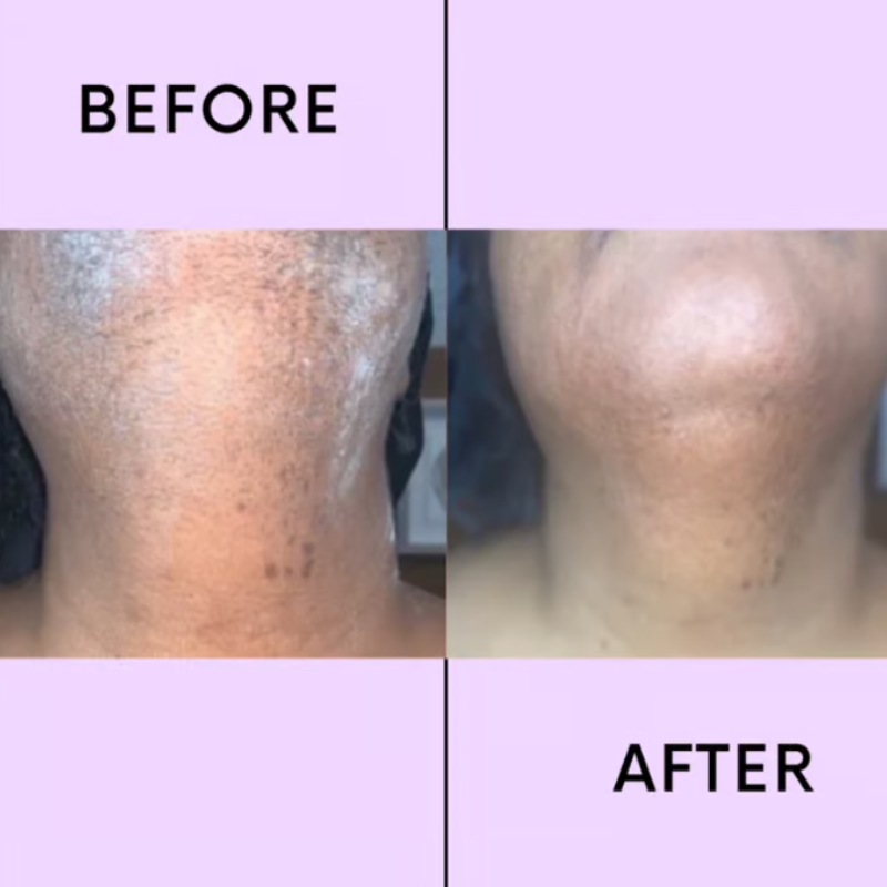 LumaSilk™ — Experience Pain-Free, Instantly Smooth Skin That Boosts Your Confidence