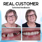 DentiSure™ Silicone Fit — Unlock Radiant Confidence with a Perfectly Secure Smile