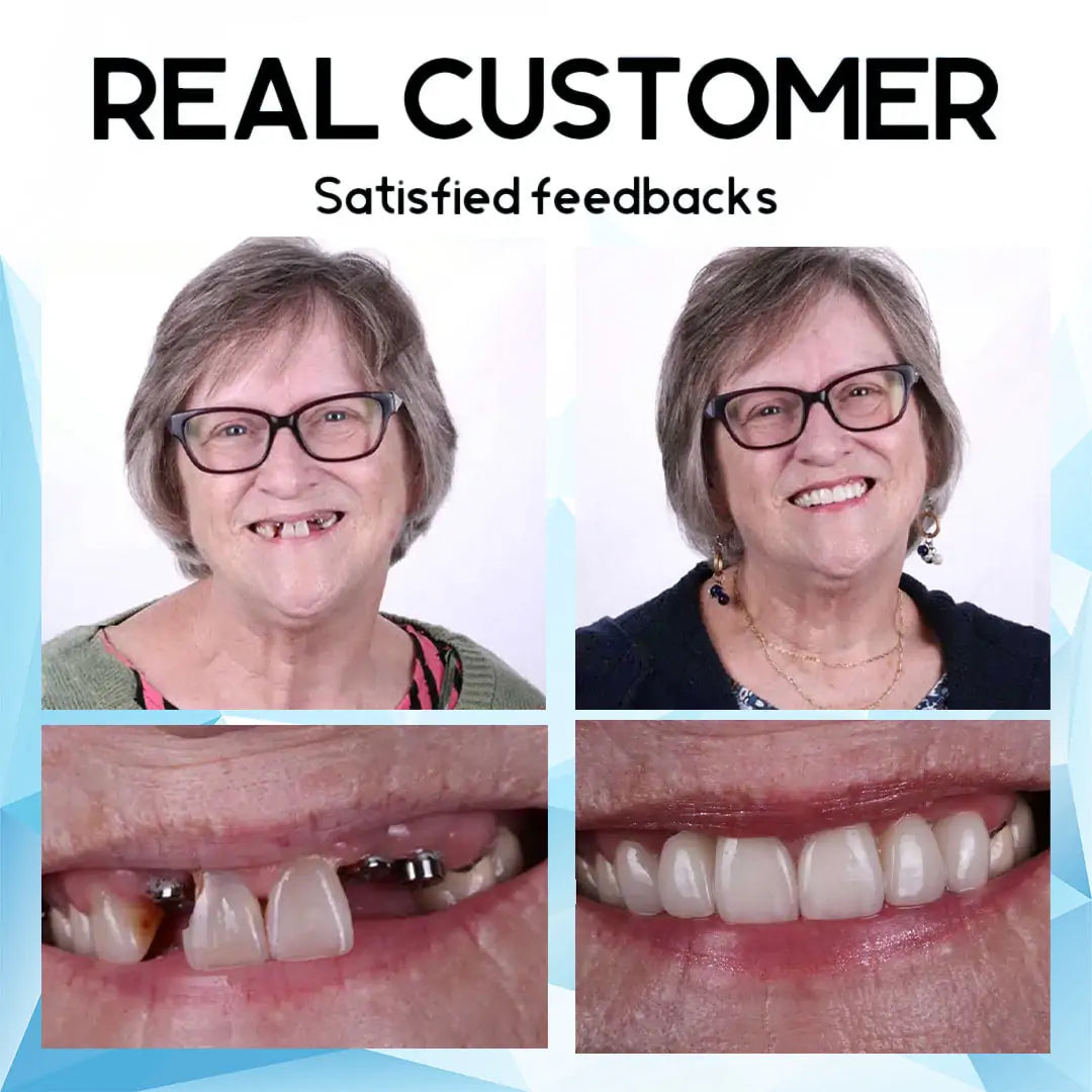 DentiSure™ Silicone Fit — Unlock Radiant Confidence with a Perfectly Secure Smile