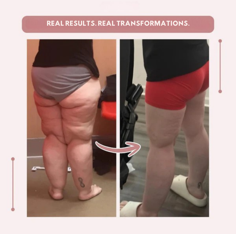 VaxaLift™ — Energize Your Legs with All-Day Support and Sculpted Confidence