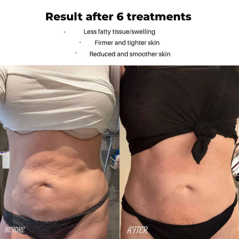 GlowNova™ — Unlock Radiant, Youthful Skin That Stops Time Every Morning