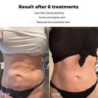 GlowNova™ — Unlock Radiant, Youthful Skin That Stops Time Every Morning