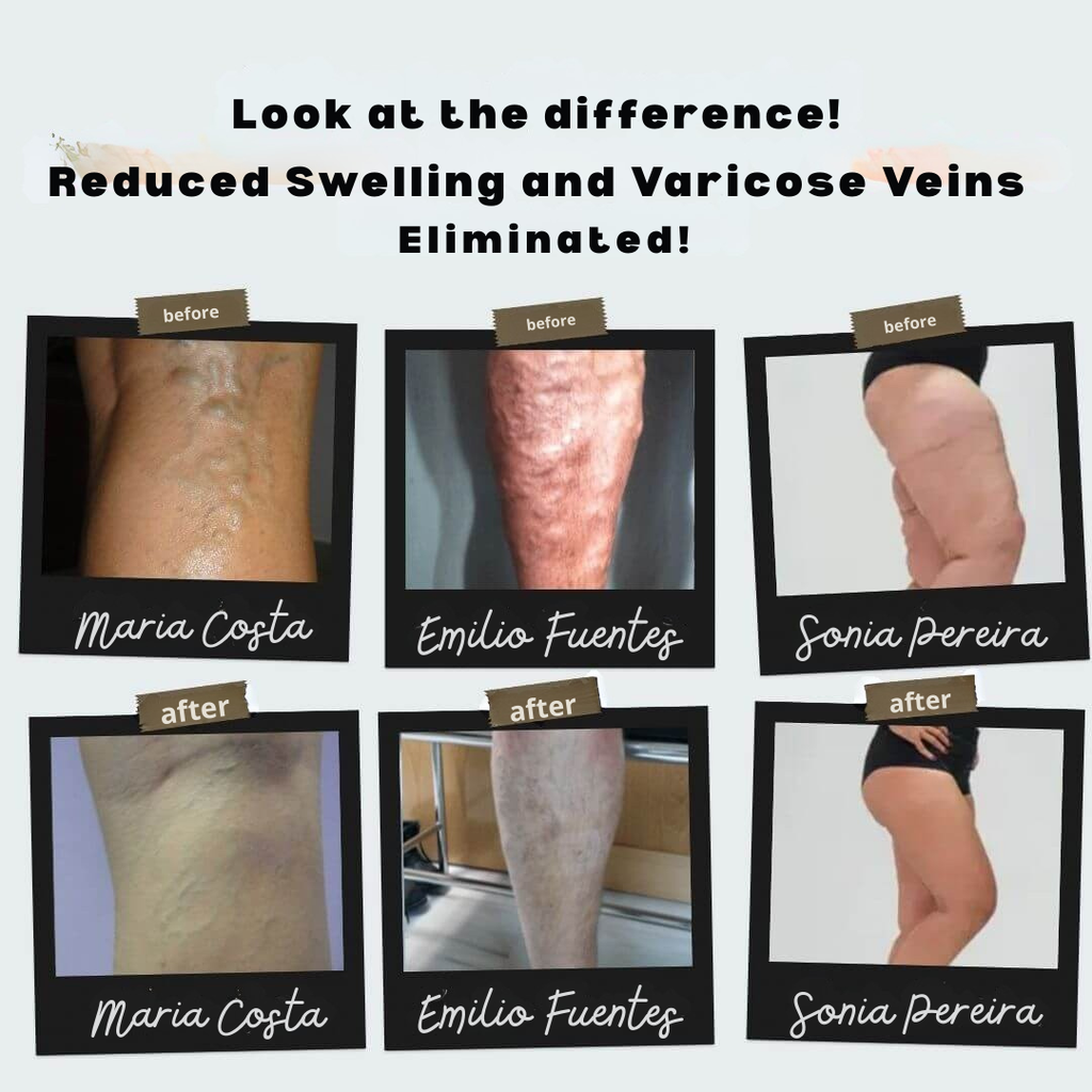 CircuEase™ — Instantly Energize Legs and Crush Pain for All-Day Freedom