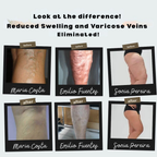 CircuEase™ — Instantly Energize Legs and Crush Pain for All-Day Freedom
