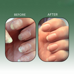 StrongLeaf™ — Transform Your Nails into Unbreakable Confidence and Radiant Strength