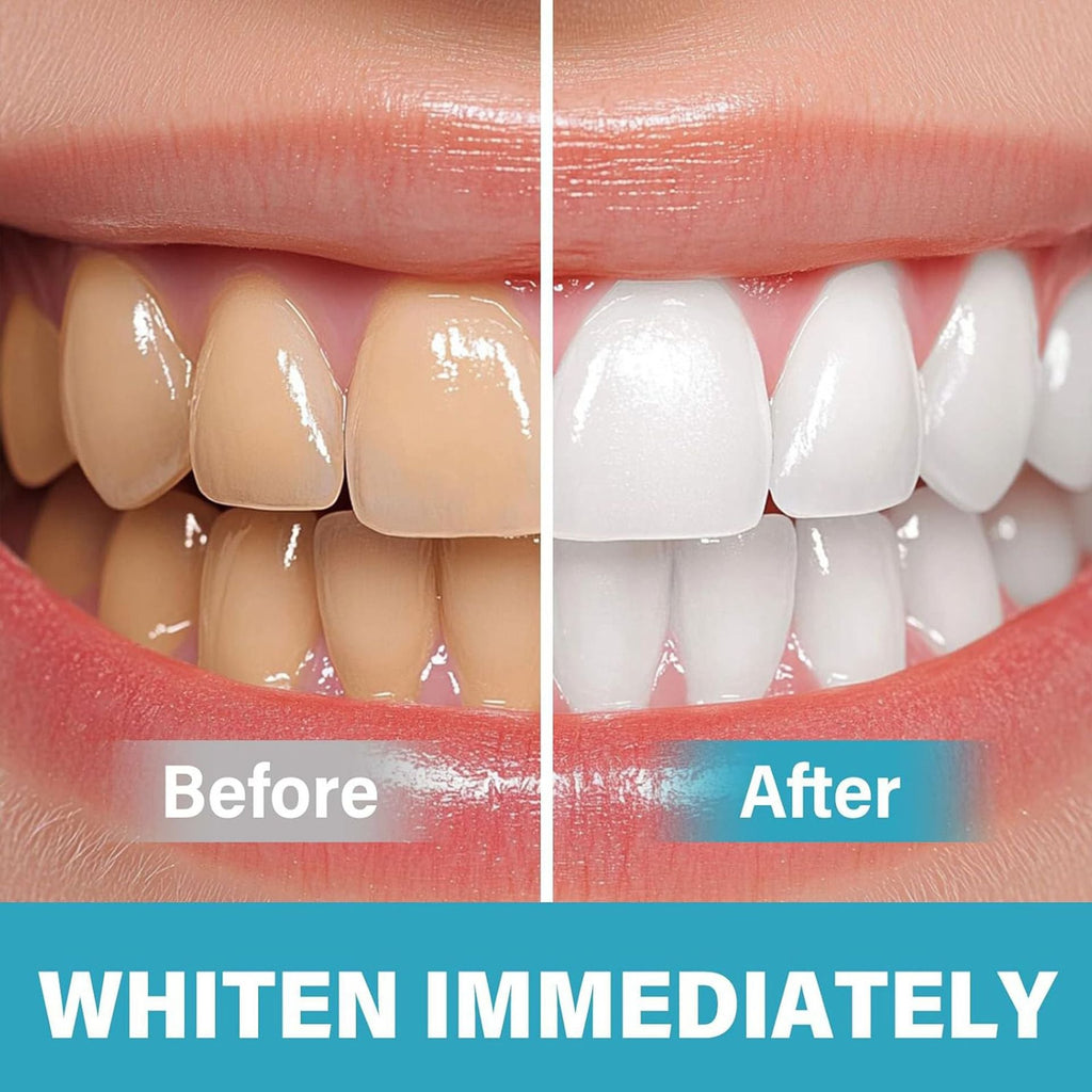 Glissence™ Teeth Whitening Serum — Unlock a Dazzling Smile Without Sensitivity or Fuss