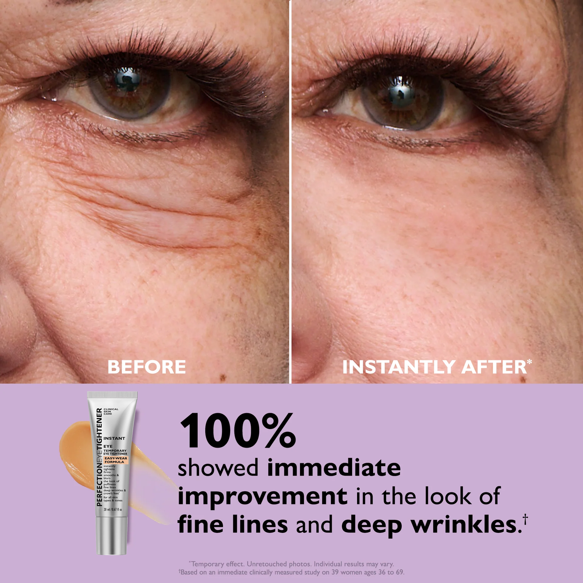 VividLume™ — Instantly Brighten and Tighten Eyes for All-Day Youthful Glow