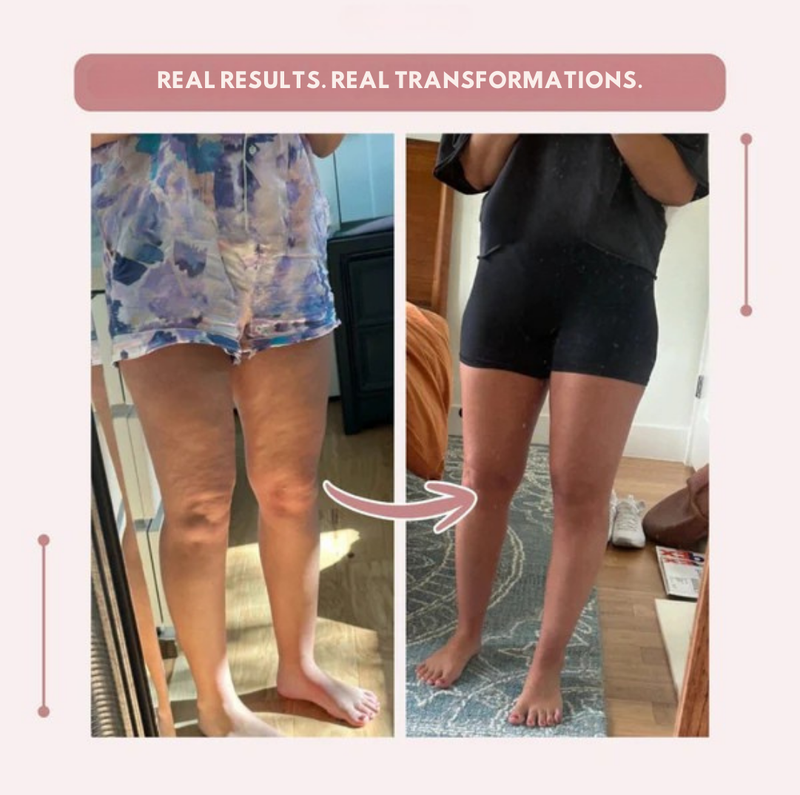 VaxaLift™ — Energize Your Legs with All-Day Support and Sculpted Confidence