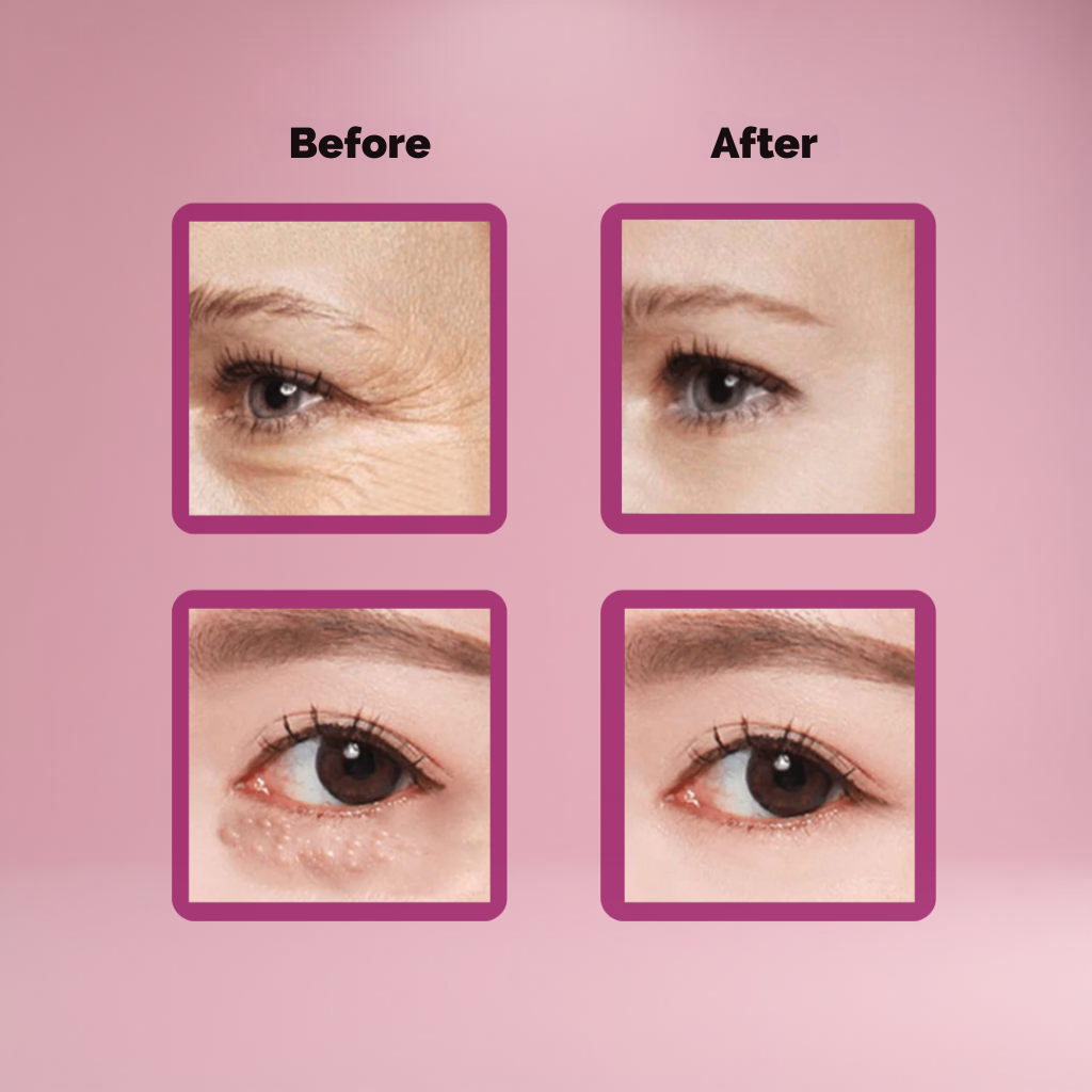 ReviBlink™ — Instantly Erase Puffiness and Unleash Youthful, Radiant Eyes