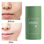 PureRadiance™ Detox Mask Stick — Instantly Clear Pores for Unstoppable Radiance and Confidence