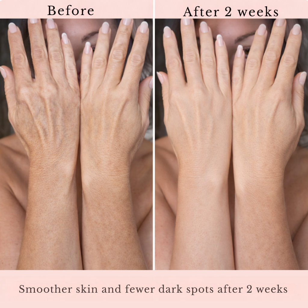 RadiantFlex™ Body Renewal Serum — Unlock Firmer, Smoother Skin That Makes You Glow with Confidence