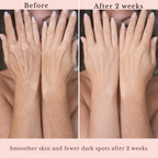 RadiantFlex™ Body Renewal Serum — Unlock Firmer, Smoother Skin That Makes You Glow with Confidence