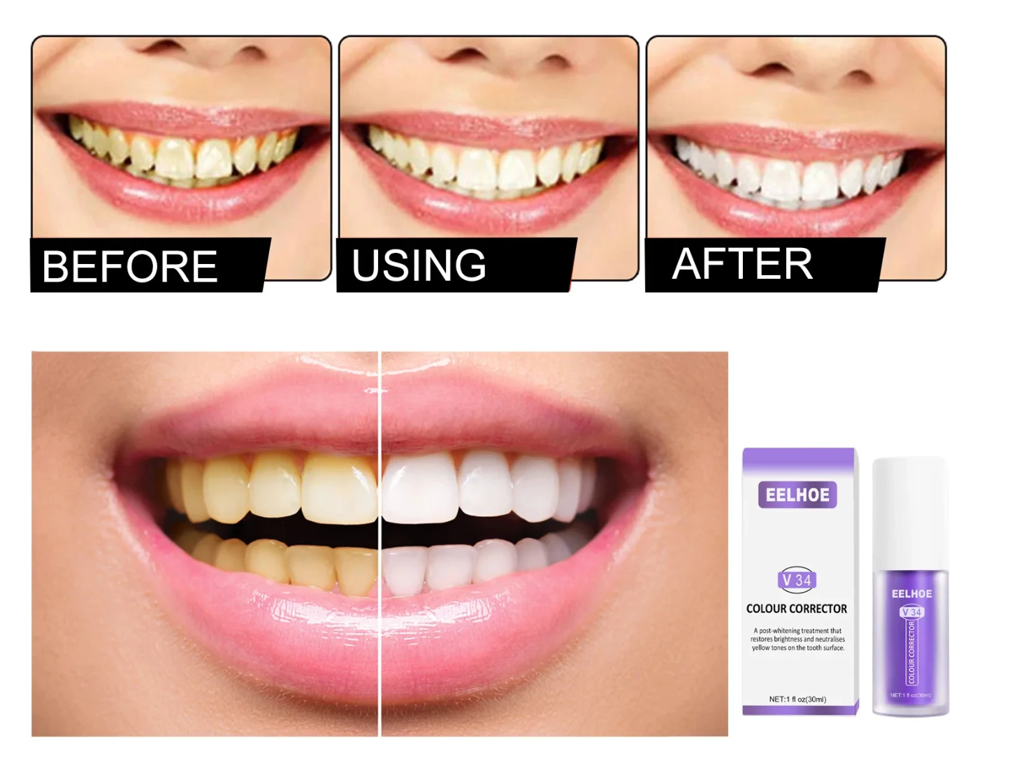 RadiantSmile™ — Instantly Ignite Confidence with Pain-Free, Dazzling Brightness