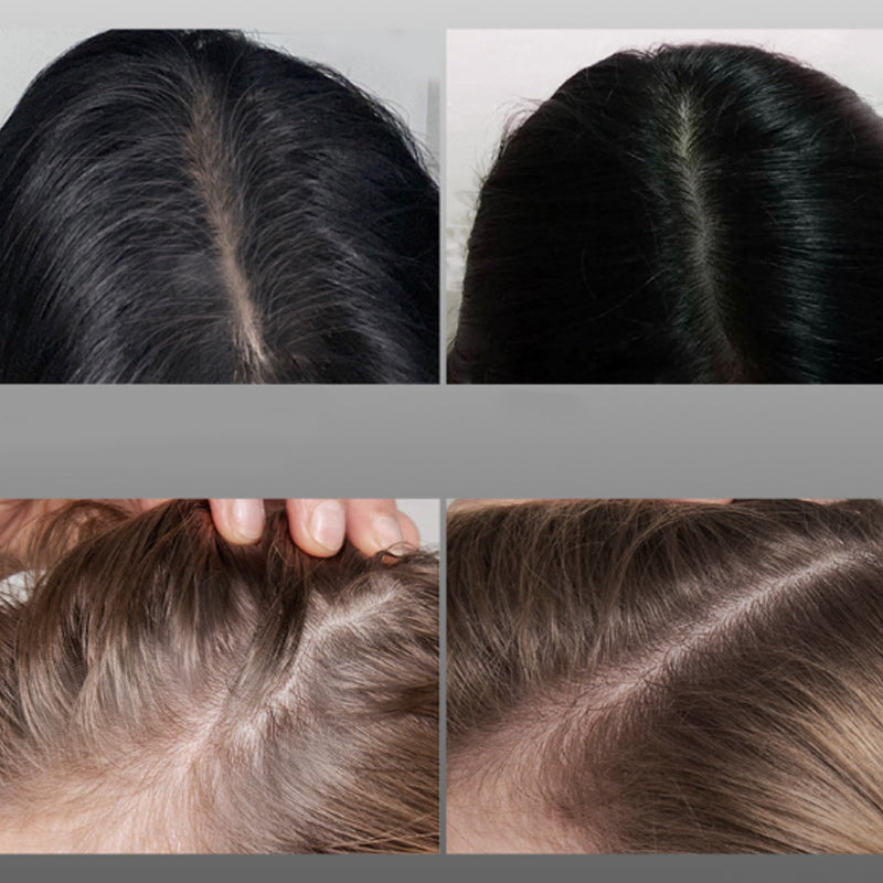 RevitaShade™ — Instantly Erase Grays for a Younger, Confident You