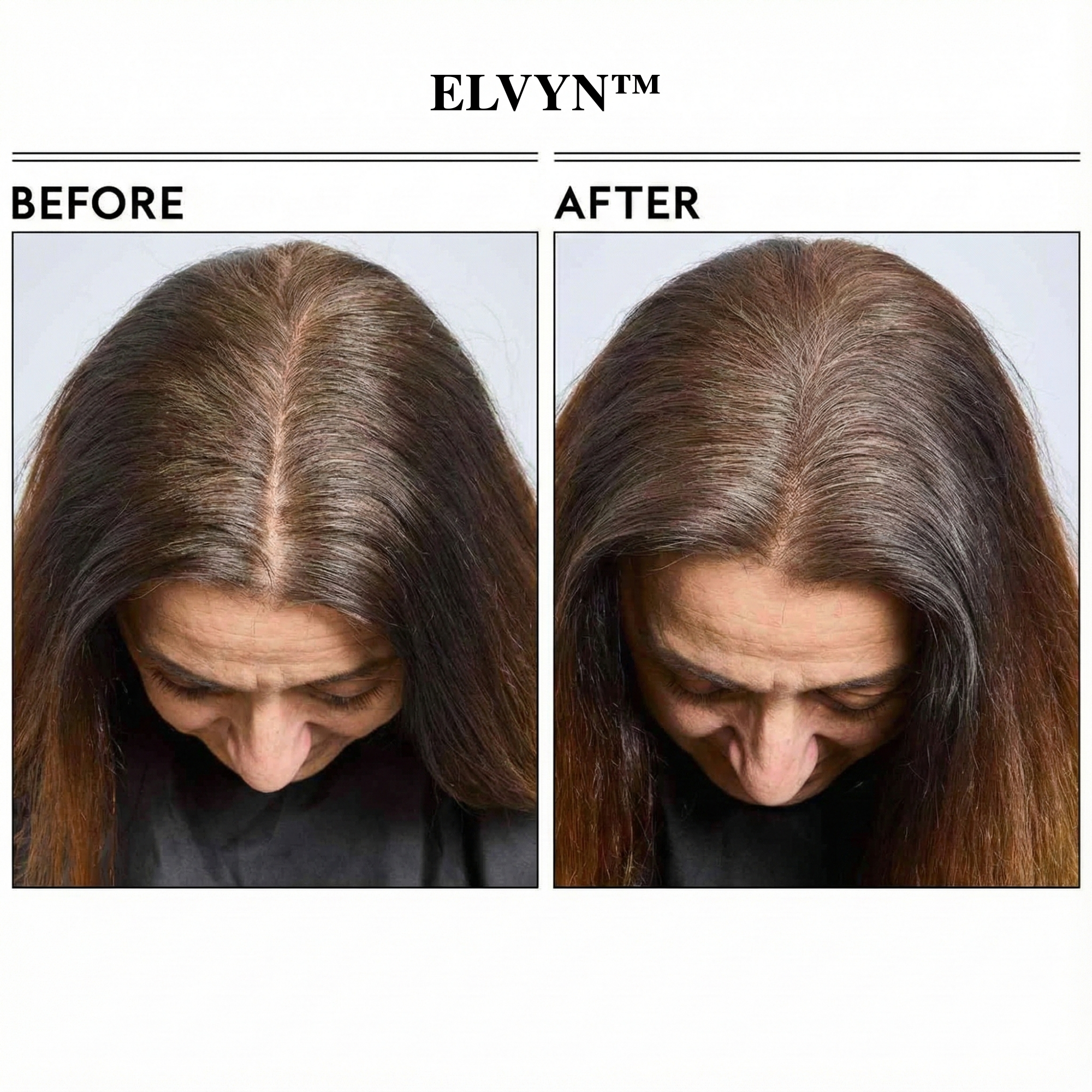 ShadeVeil™ — Instantly Reclaim a Fuller, Younger Hairline That Turns Heads Every Time