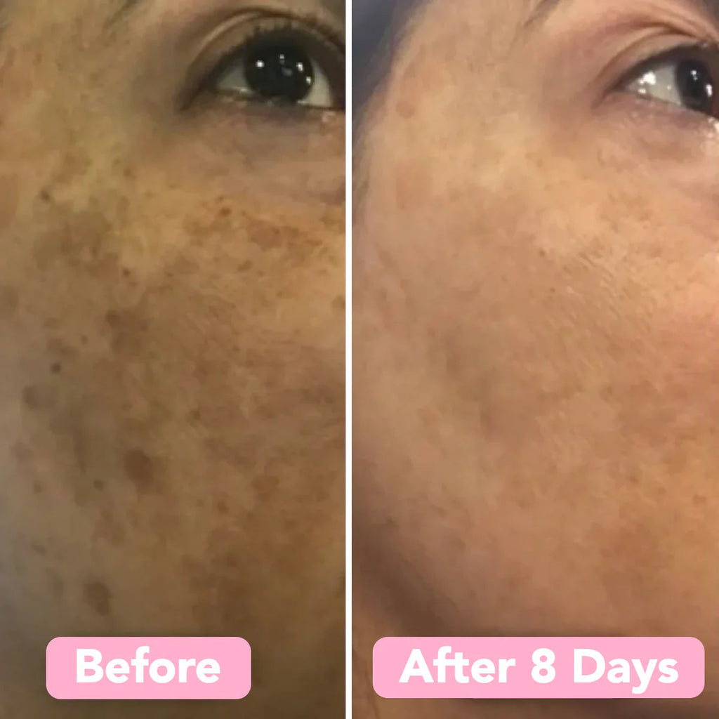 LuminaForte™ — Wake Up to Effortless Radiance That Turns Heads Every Morning