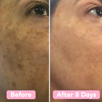 LuminaForte™ — Wake Up to Effortless Radiance That Turns Heads Every Morning