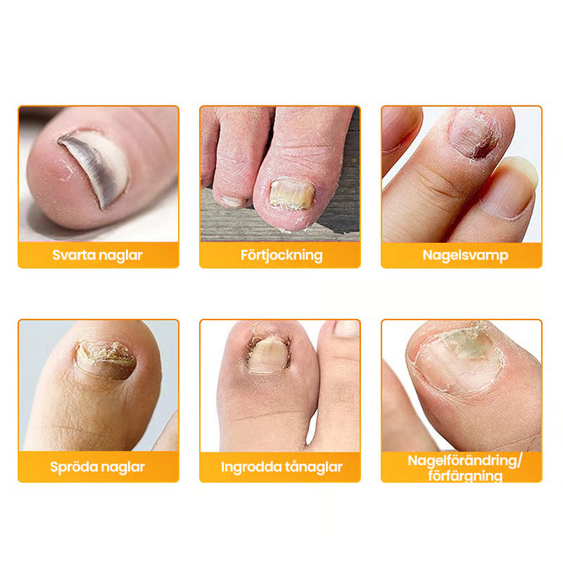 LumaDerm™ — Clear, Strong Nails That Let You Shine Without Shame