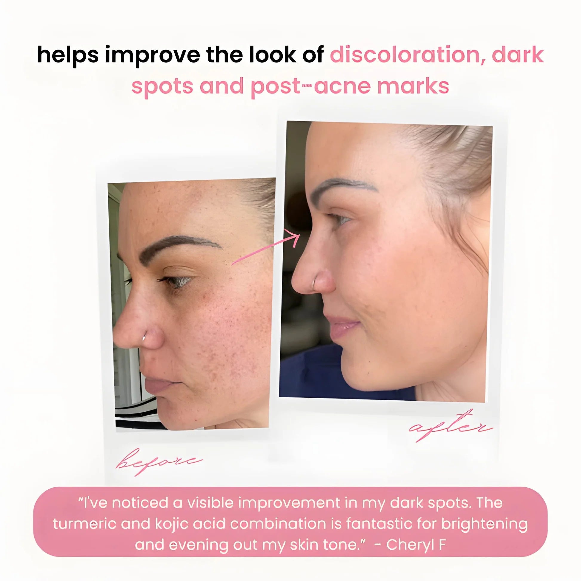 LuminaForte™ — Wake Up to Effortless Radiance That Turns Heads Every Morning