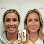 LumaVive™ — Reveal Firmer, Youthful Skin That Radiates Confidence Every Day