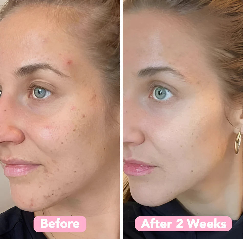 LuminaForte™ — Wake Up to Effortless Radiance That Turns Heads Every Morning