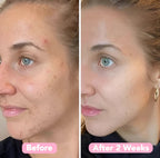 LuminaForte™ — Wake Up to Effortless Radiance That Turns Heads Every Morning