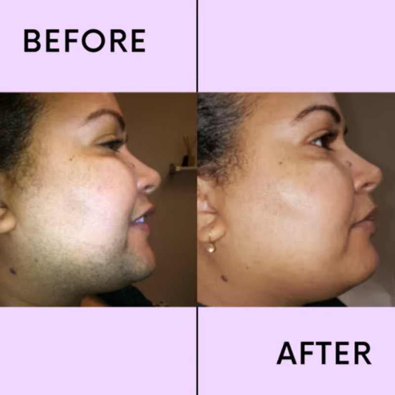 LumaSilk™ — Experience Pain-Free, Instantly Smooth Skin That Boosts Your Confidence