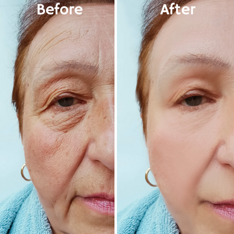 LumaRise™ — Instantly Lift and Glow with Unstoppable Confidence Every Day