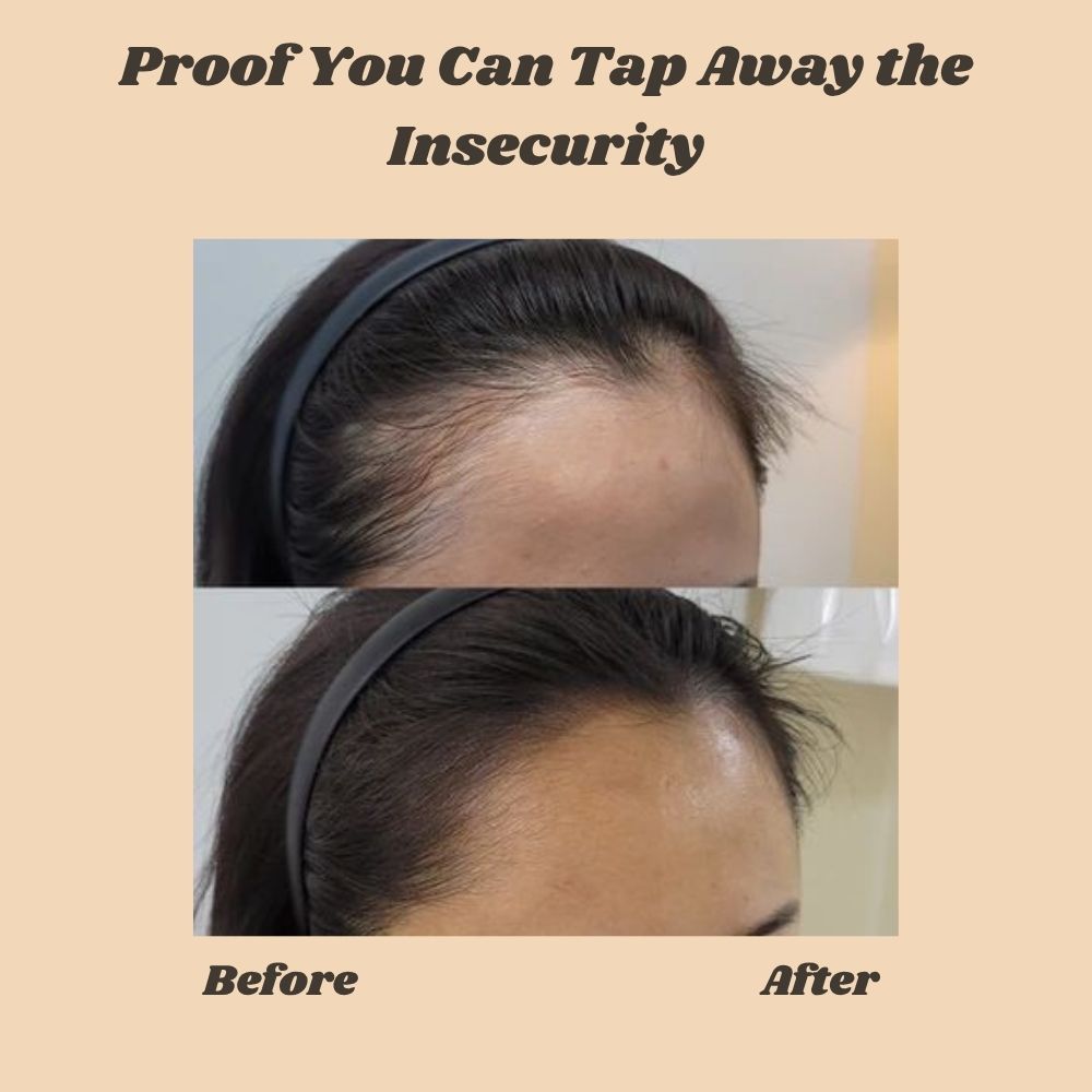 VolumiVibe™ — Instantly Transform Thinning Hair Into Unstoppable Confidence