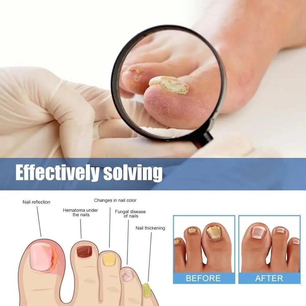 NailRevive™ — Unlock Clear, Strong Nails You’ll Proudly Flaunt Every Day