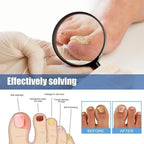 NailRevive™ — Unlock Clear, Strong Nails You’ll Proudly Flaunt Every Day