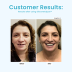 ComfortNest™ — Feel Pain-Free Confidence with Every Smile
