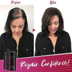 VolumeLuxe™ — Transform Thin, Patchy Hair into a Bold, Youthful Crown Instantly