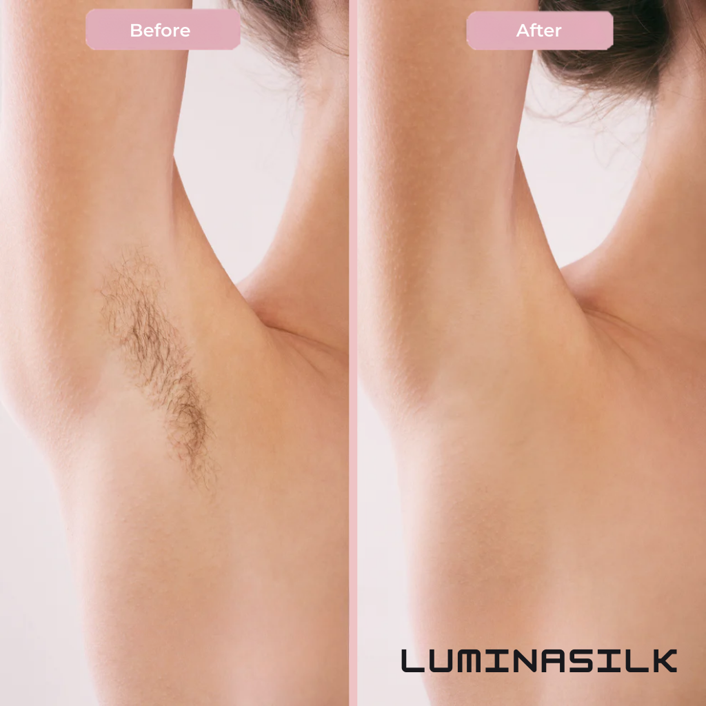 Silklyn™ — Glide to Radiant, Irritation-Free Skin That Commands Attention