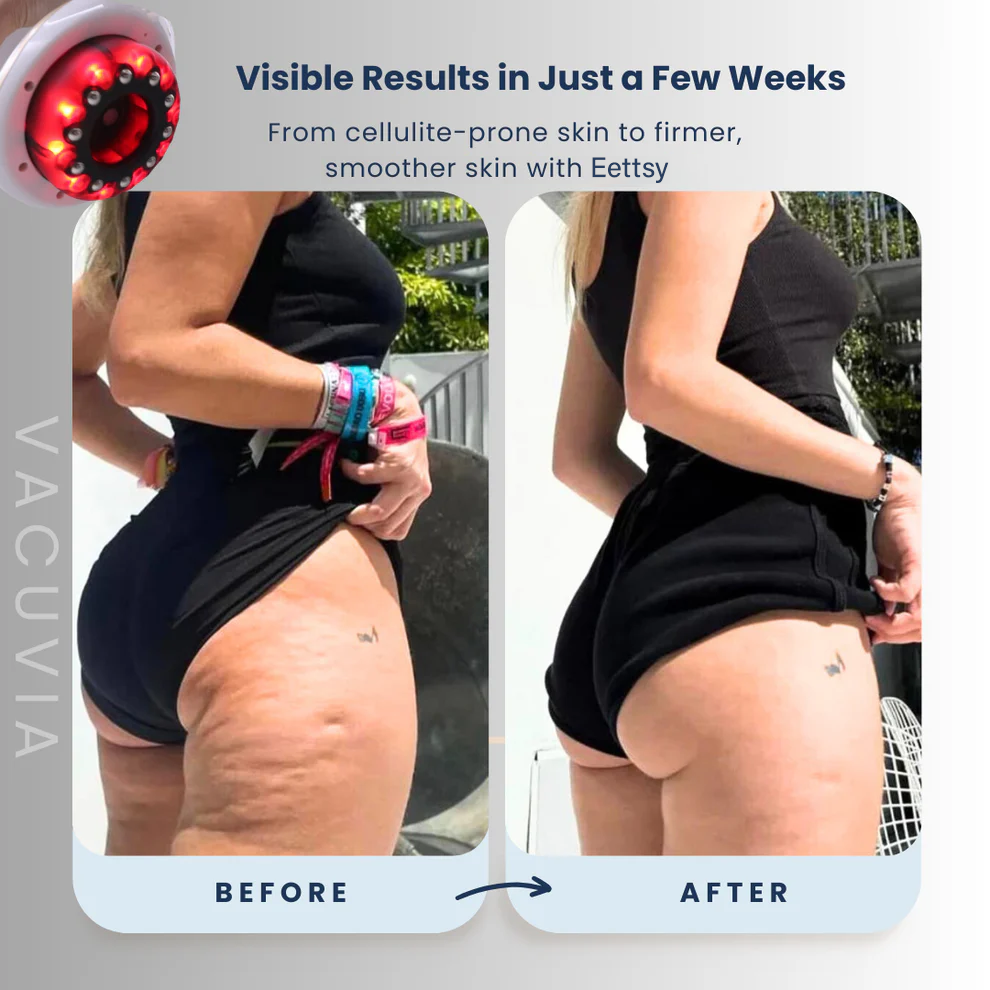 RadiantSkinPro™ — Ignite Your Glow and Snap Skin Tight for Unstoppable Confidence
