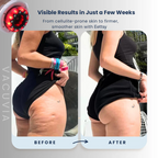 RadiantSkinPro™ — Ignite Your Glow and Snap Skin Tight for Unstoppable Confidence
