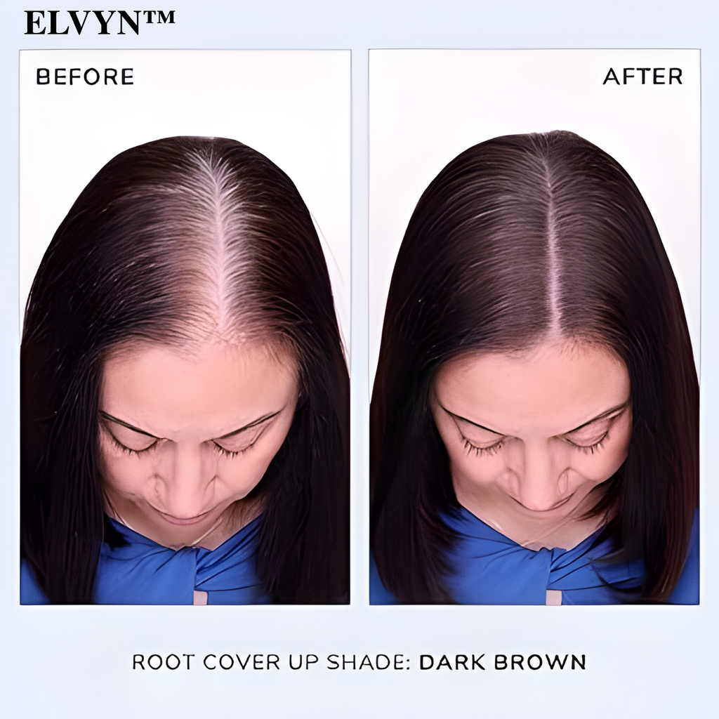 ShadeVeil™ — Instantly Reclaim a Fuller, Younger Hairline That Turns Heads Every Time