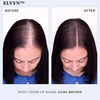 ShadeVeil™ — Instantly Reclaim a Fuller, Younger Hairline That Turns Heads Every Time