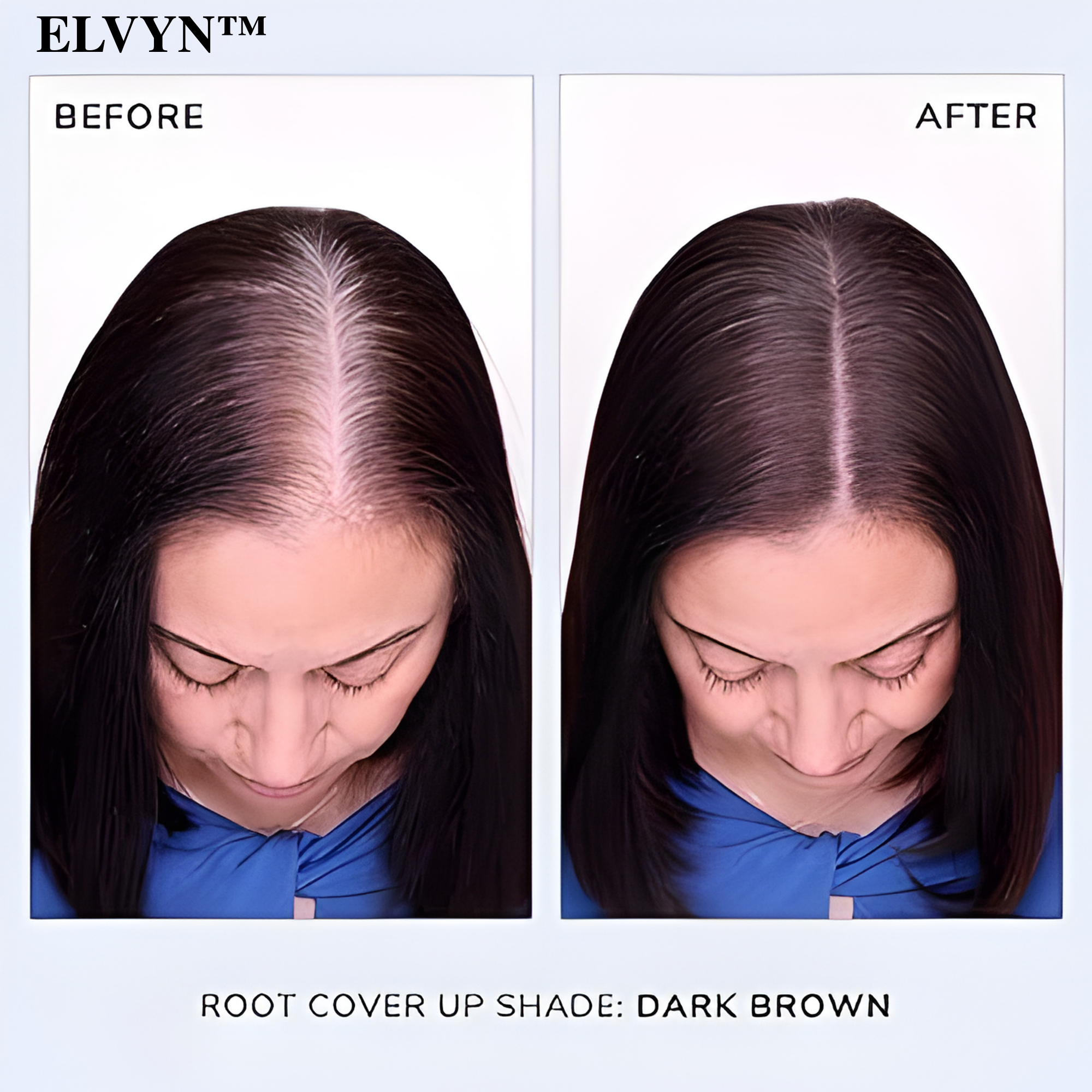 ShadeVeil™ — Instantly Reclaim a Fuller, Younger Hairline That Turns Heads Every Time